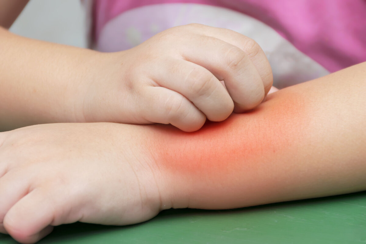 Ni Mosquito ni Osa: najstrašéjšhi uznizni Zvieraťa ove godine. Ak ga prepoznaje?