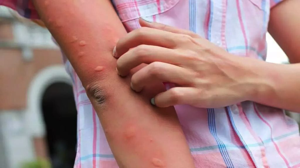 Ni Mosquito ni Osa: najstrašéjšhi uznizni Zvieraťa ove godine. Ak ga prepoznaje?