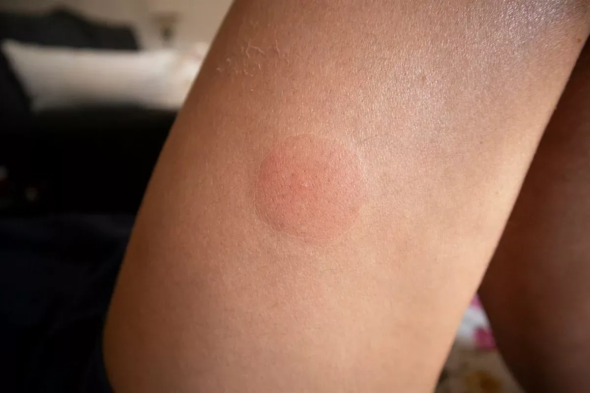 Ni Mosquito ni Osa: najstrašéjšhi uznizni Zvieraťa ove godine. Ak ga prepoznaje?